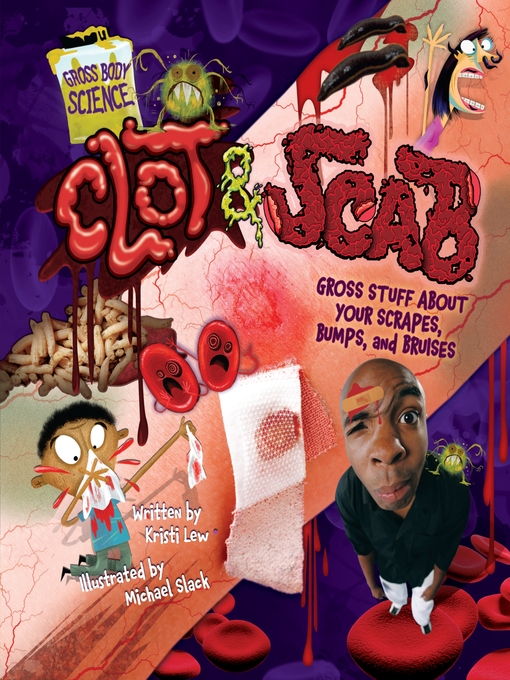 Title details for Clot & Scab by Kristi Lew - Available